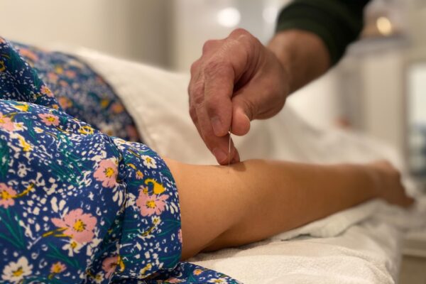 Forståelse af Akupunktur: En Guide til Smertefri Livsstil